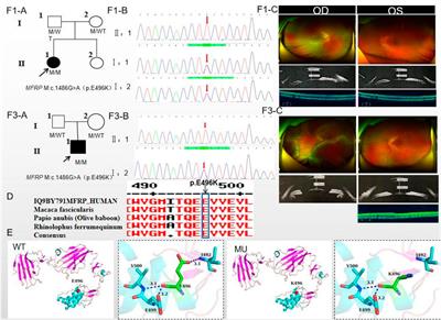 MFRP variations cause nanophthalmos in five Chinese families with distinct phenotypic diversity